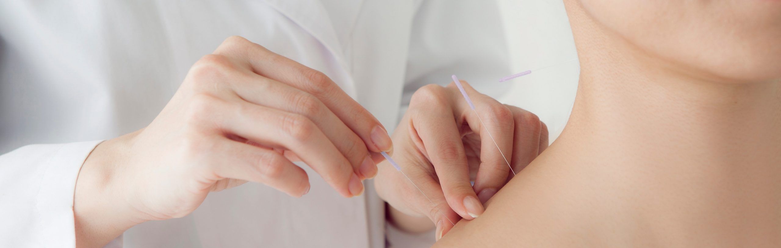 Servicios de Acupuntura Barcelon
