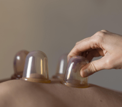 Tratamiento con ventosas